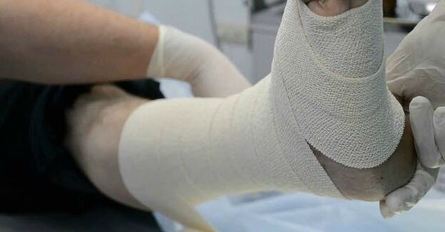 Elastesch Bandage