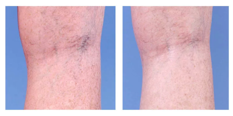 Kosmetesch Korrektur